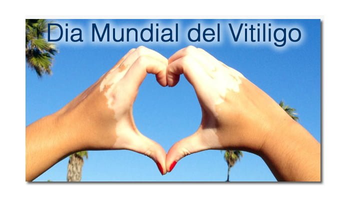DIA MUNDIAL DEL VITÍLIGO